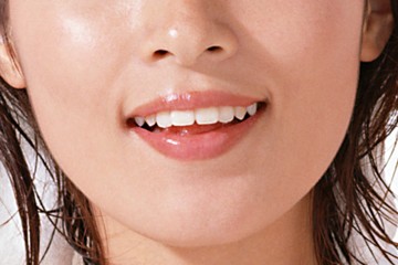 金属を使わない治療で自然な口元を実現