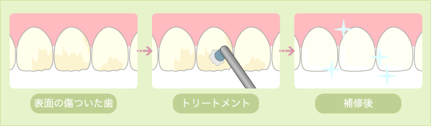 歯の健康は日々のケアと定期的なメンテナンスで守りましょう