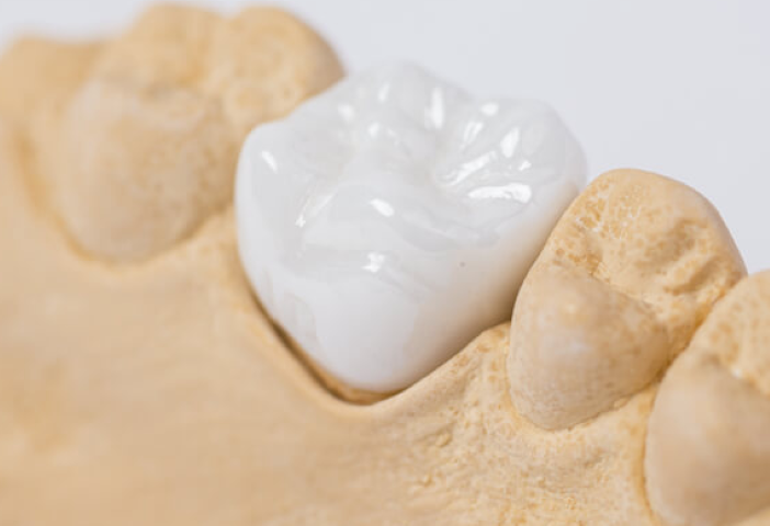 美しい笑顔をサポートする補綴治療