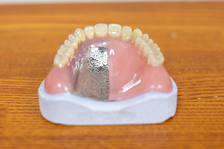 金属製の入れ歯などもあります