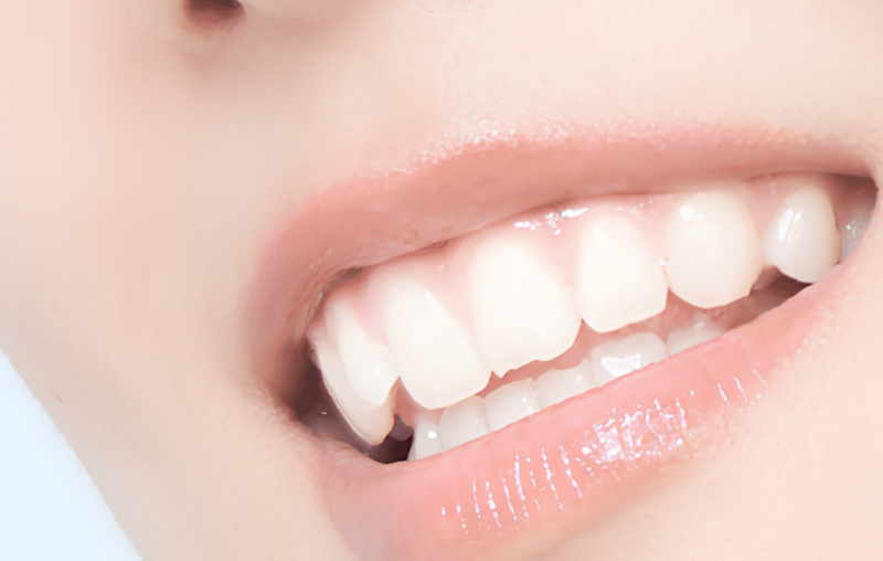 周囲の歯を削らず機能性と審美性を回復する最適な欠損補綴