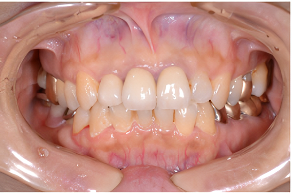 日本矯正歯科学会認定医による精密分析と個別対応で理想の歯並びを実現