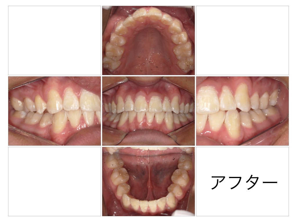 歯並びやかみ合わせに関するお悩みがありましたら、お気軽にご相談ください。