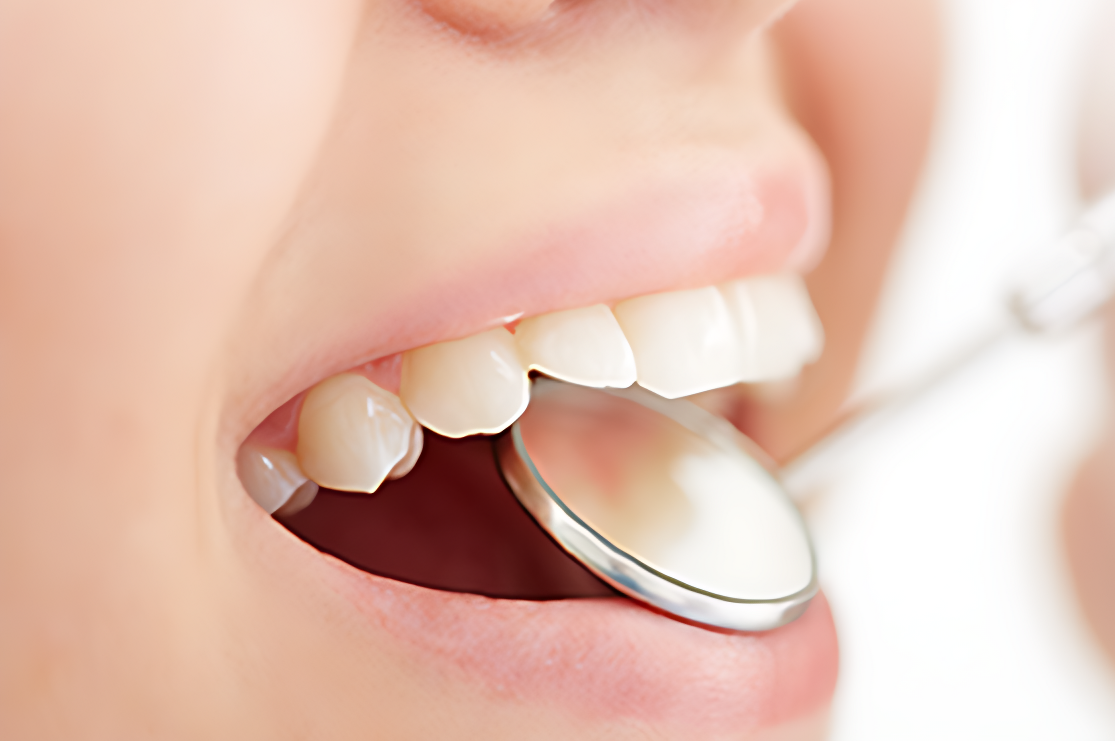 セラミックとCAD/CAMシステムを駆使した精密な審美修復の実現