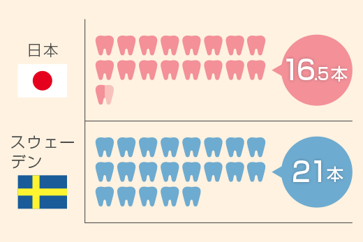 予防歯科の意識が高いスウェ―デンと日本で70歳の平均残存歯を比較