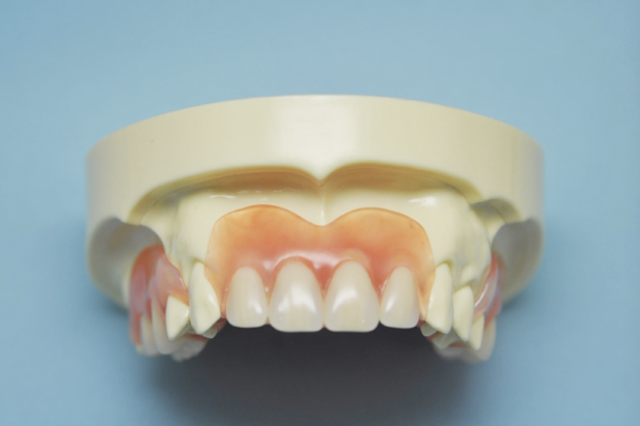 顎に優しい入れ歯