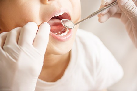 定期的な歯科検診をおすすめします