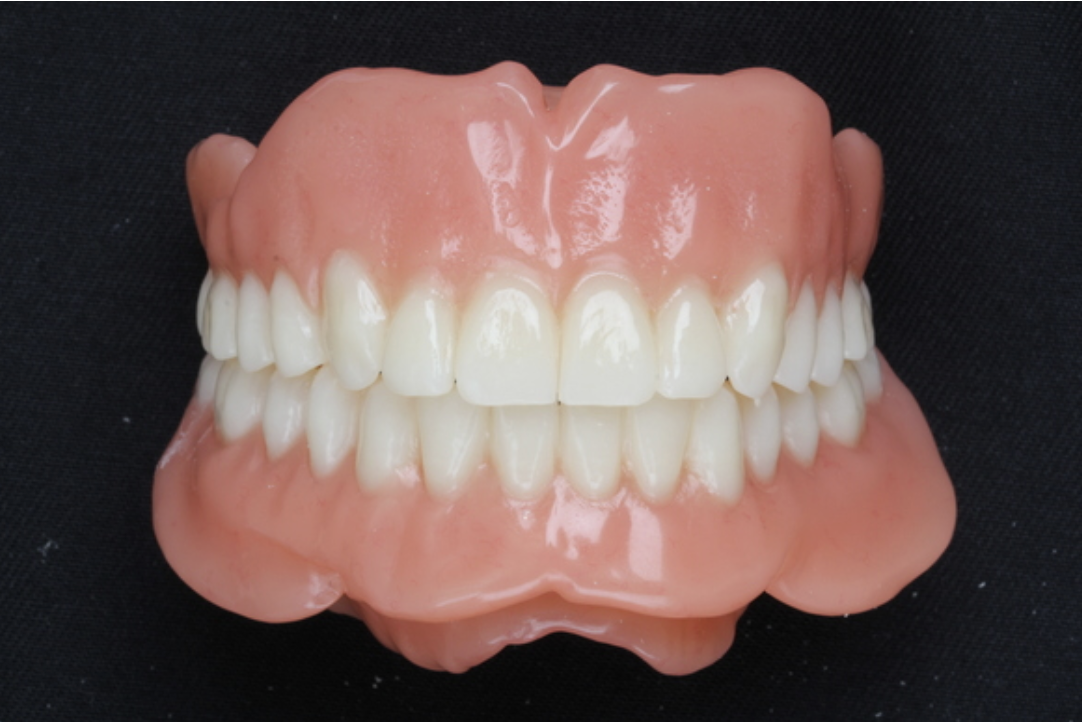 他院では真似できない装着時の痛みや違和感を最小限に抑えた入れ歯を実現