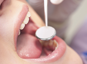 定期健診を受けることが、天然の歯を長く残すことにつながります