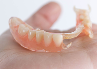 ノンクラスプデンチャー