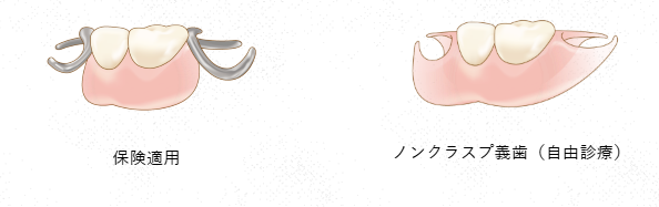 失った歯を補うことで、しっかりと咀嚼できるようになり、食事や会話を楽しむことができるようになります。