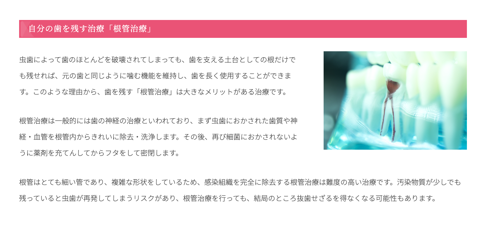 根管治療を丁寧に行い、患者様の大切な歯を可能な限り保存することを目指しています