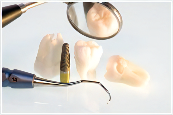 インプラント治療を提供