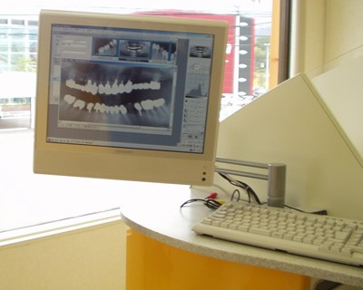 レントゲンをデジタル化し被爆量を軽減しています