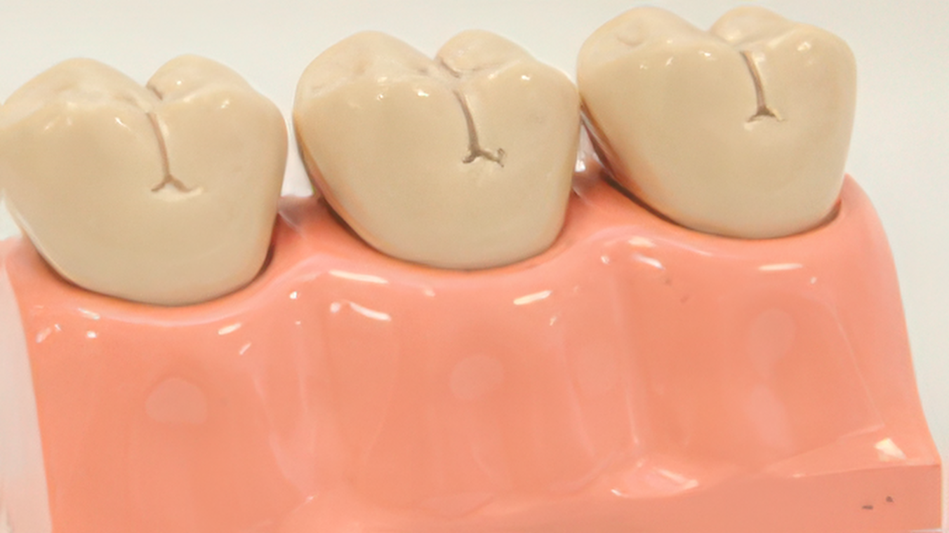 患者様に合った入れ歯を