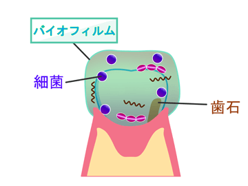 初期段階からの検査とクリーニングを重視し、歯周病を進行させない取り組みを行っています