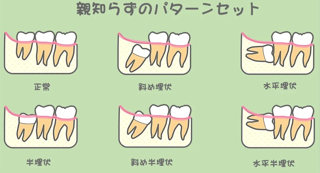 必要に応じた処置を行います