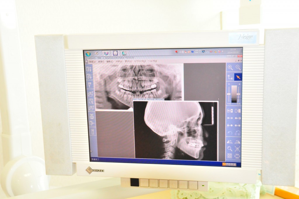 目立ちにくい装置や丁寧な説明で、納得のいく矯正治療を提供