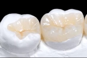 複数の素材から患者様の状態やご要望に合わせた選択肢を提供しています