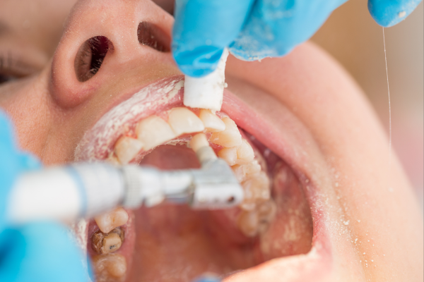 ※画像はイメージです