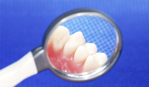 日々の適切なケアが大切です