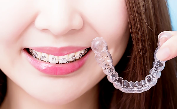 日本矯正歯科学会認定医が在籍し、お子様から成人まで幅広い年齢層の矯正治療に対応しています