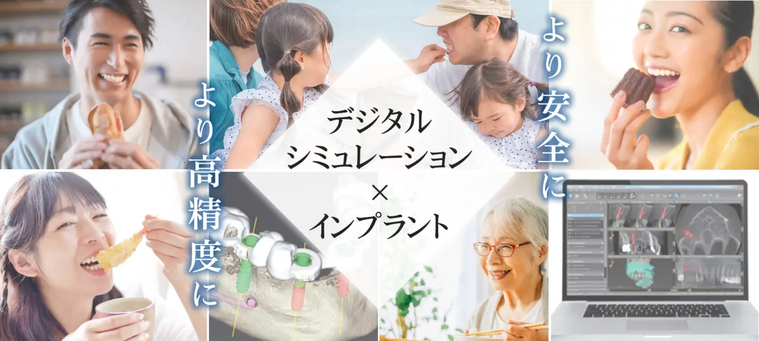 デジタルシミュレーションに基づき、精密な手術計画を行っています