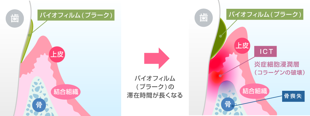歯周病の予防と改善を通じて、年齢を重ねても歯を残せる口腔環境の維持に取り組んでいます