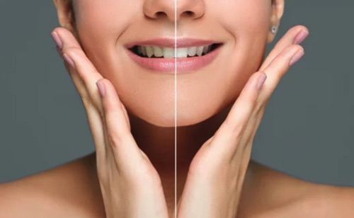 白い歯で自信が持てます