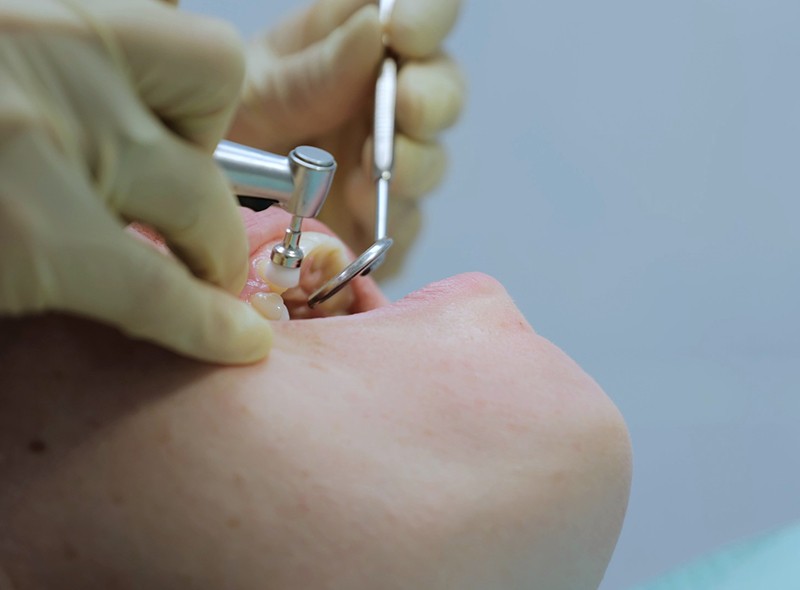 口腔内の状態を正確に把握