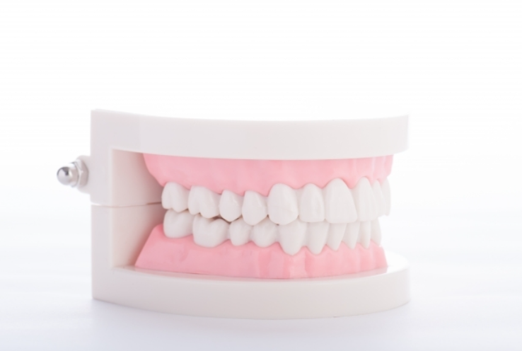 多様な素材選択と丁寧な調整で残存歯を守り口腔機能を回復する入れ歯