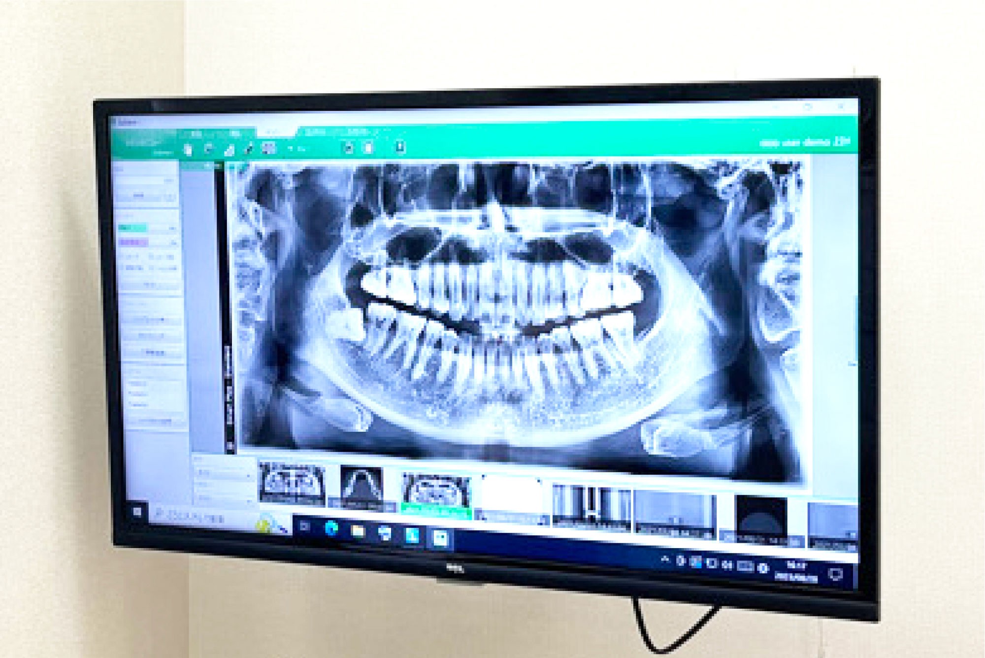 【土曜診療・駐車場完備】地域の健康をお口から支える坪井歯科医院