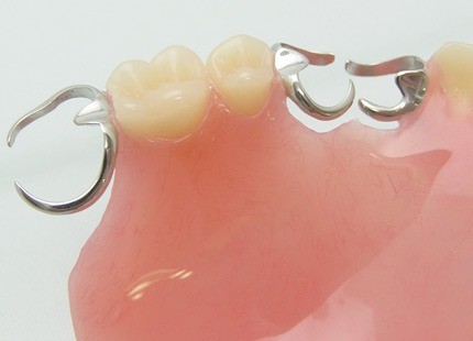 歯を失った後も安心して食事や会話を楽しめるよう、機能回復と生活の質向上を支える治療に取り組んでいます。