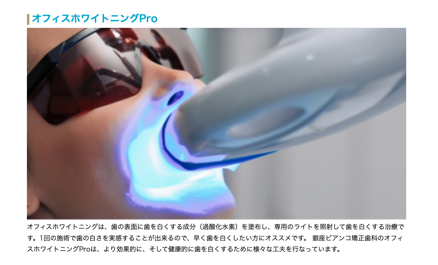 患者様の明るい笑顔をさらに引き立てるため、3種類のホワイトニングメニューを提供しています