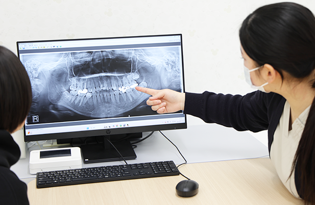 成長段階に応じた2段階治療システムで理想的な歯並びを実現します。