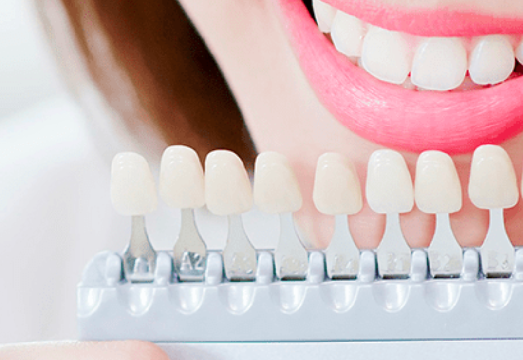 最新技術で美しい白い歯を実現します