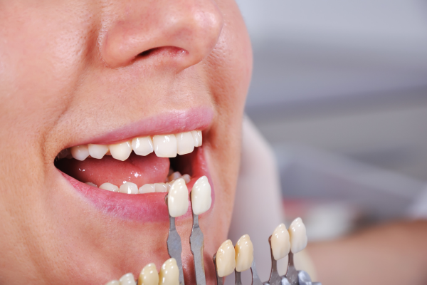 ※画像はイメージです