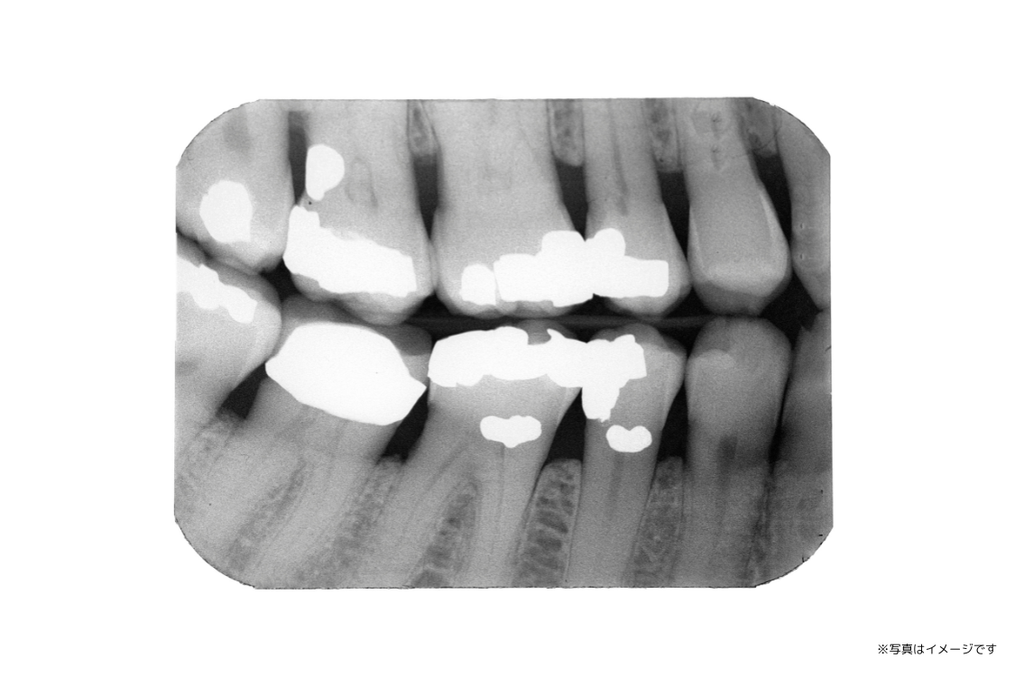 診療のはじめに丁寧な検査を行い、患者様一人ひとりの状態を把握したうえで治療計画を立てています