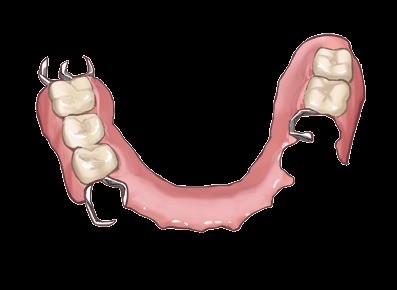口腔状態や生活背景、ご希望に合わせた義歯設計を行い、長く快適に使える入れ歯治療を提供しています。