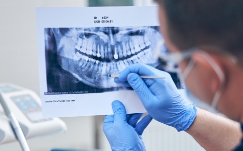 できれば歯を抜きたくない方へ