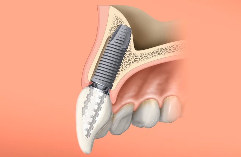 ※画像はイメージです。