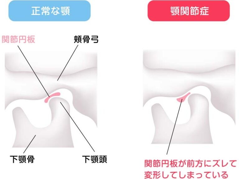 親知らずの抜歯、顎関節症、歯の破折、お口の外傷、粘膜の異常など、むし歯や歯周病以外の幅広い症状に対応しています。