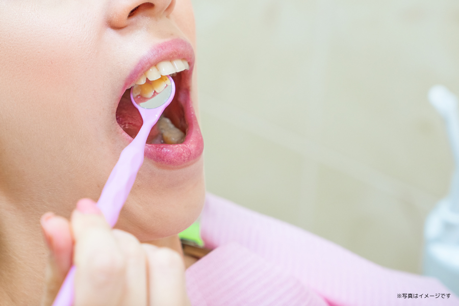 虫歯や歯周病は、早期の予防や適切なケアによって大きなトラブルを未然に防ぐことが可能です