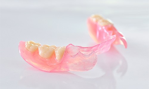 ノンクラスプデンチャーという金属バネのない入れ歯です