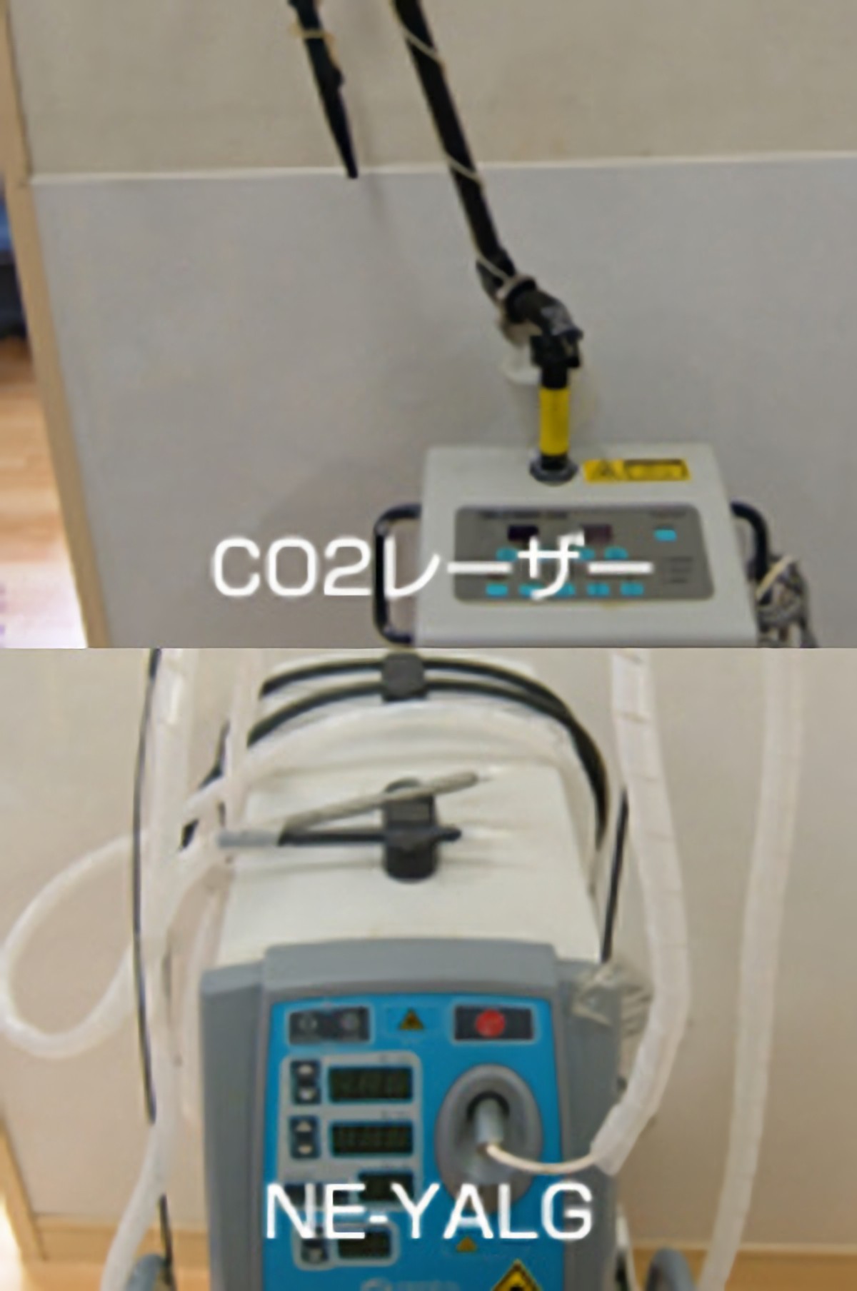 レーザー治療器