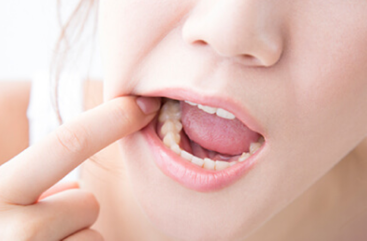 むし歯ケアは、お子様から大人まで安心して受けられます。