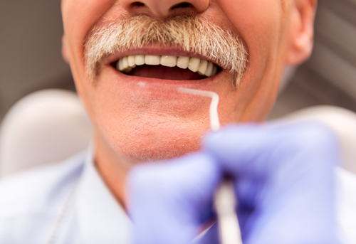 日々のケアについてしっかりご指導させていただきます。