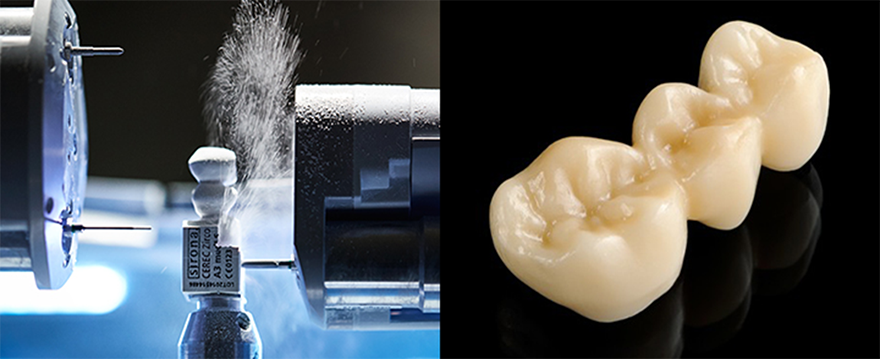 スピーディーな治療が可能です