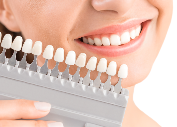 天然歯のような自然な美しさを実現する最新の審美歯科治療