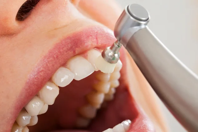 専用プログラムによるメンテナンスで再発を防止